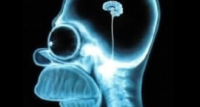 BrainScanHomerSimpson